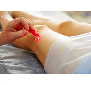 Лазерна акупунктура Лазерна акупунктура