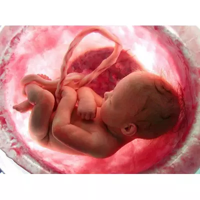 Медицинская помощь матери при патологических состояниях плода